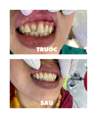 https://www.nhakhoalongtrang.com/wp-content/uploads/2022/01/10-1.png