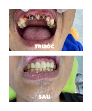 https://www.nhakhoalongtrang.com/wp-content/uploads/2022/01/11-1.png