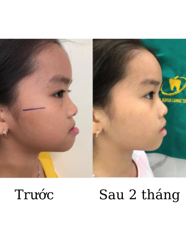 https://www.nhakhoalongtrang.com/wp-content/uploads/2022/01/3-6.png