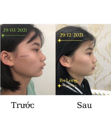 https://www.nhakhoalongtrang.com/wp-content/uploads/2022/01/5-3.png