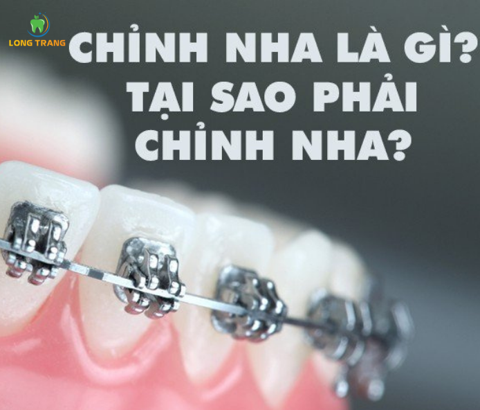 https://www.nhakhoalongtrang.com/wp-content/uploads/2022/01/Chinh-nha.png