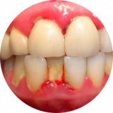 https://www.nhakhoalongtrang.com/wp-content/uploads/2022/01/gd2-160x160.png