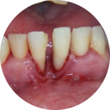 https://www.nhakhoalongtrang.com/wp-content/uploads/2022/01/gd4-160x160.png