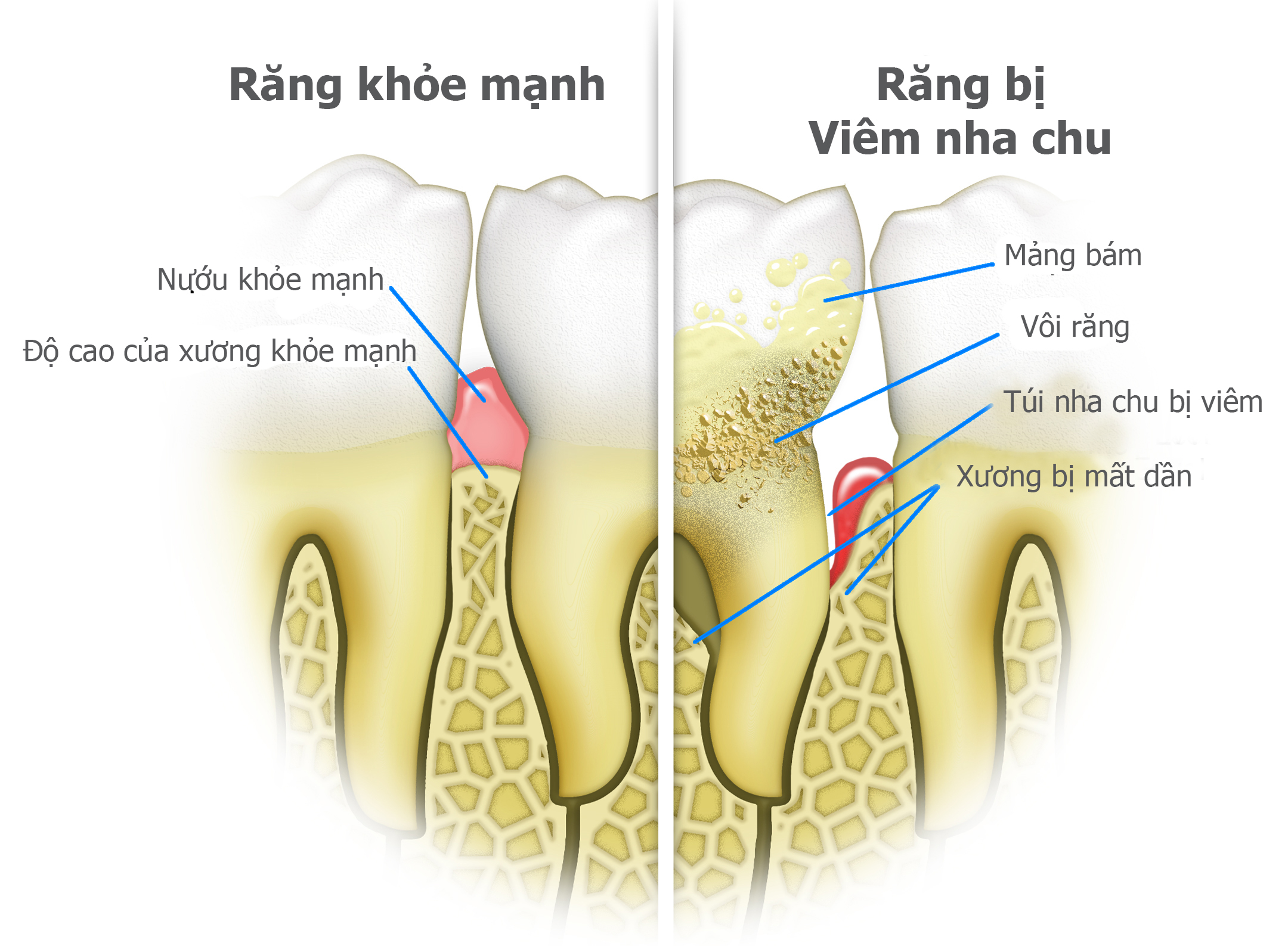 https://www.nhakhoalongtrang.com/wp-content/uploads/2022/01/nc2.jpg