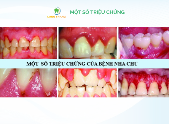 https://www.nhakhoalongtrang.com/wp-content/uploads/2022/01/nc3.png