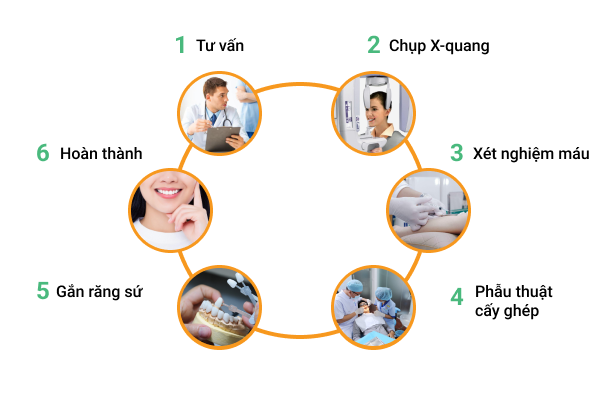 https://www.nhakhoalongtrang.com/wp-content/uploads/2022/01/rtm1.png